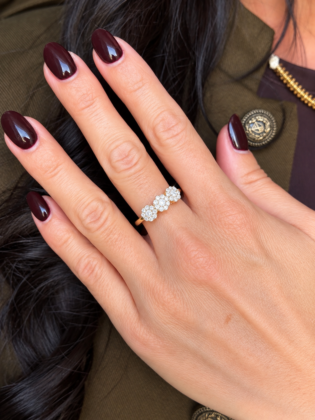 Anello Magic